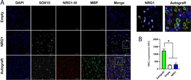 https://cdn.ncbi.nlm.nih.gov/pmc/blobs/d51f/10659554/226d4ae33754/nihpp-rs3429258v1-f0011.jpg
