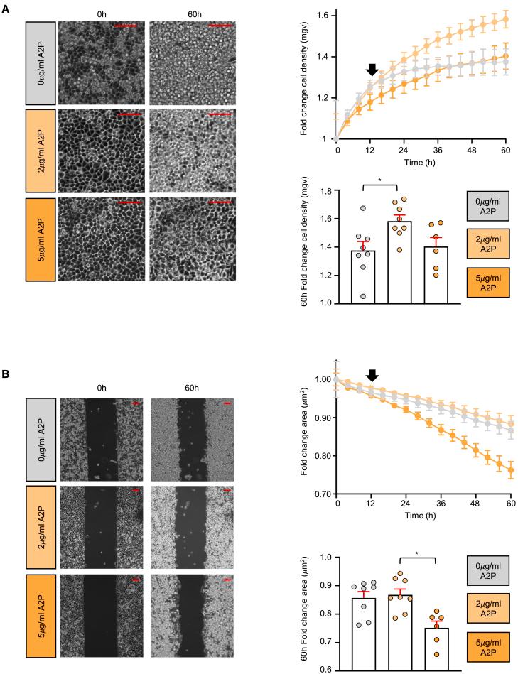 https://cdn.ncbi.nlm.nih.gov/pmc/blobs/d52a/12304772/445e56c2ebdf/gr4.jpg