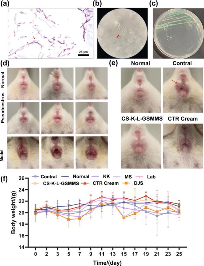 https://cdn.ncbi.nlm.nih.gov/pmc/blobs/d52c/11947829/99800aea22cf/ao4c11016_0005.jpg