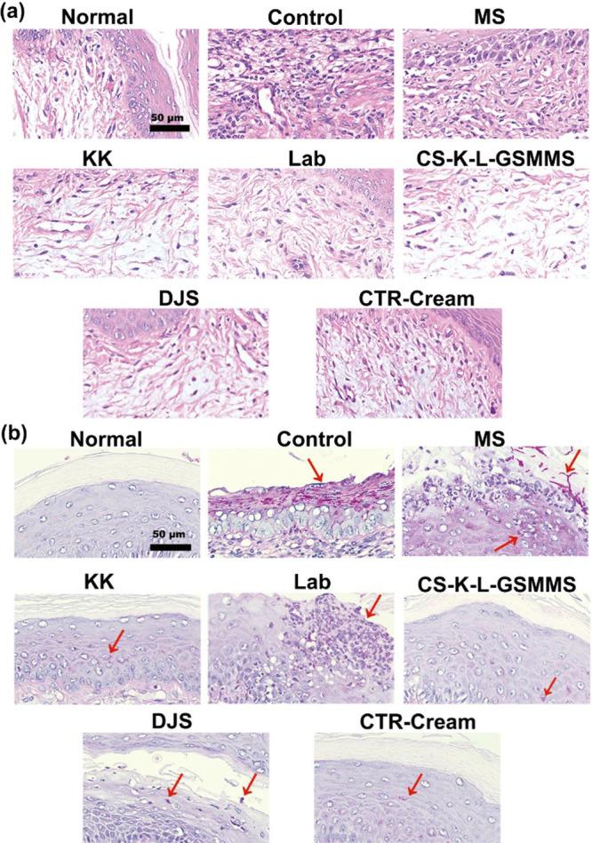 https://cdn.ncbi.nlm.nih.gov/pmc/blobs/d52c/11947829/d05e5036d29b/ao4c11016_0008.jpg