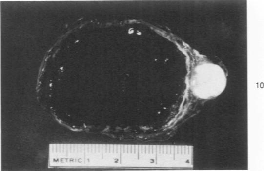 https://cdn.ncbi.nlm.nih.gov/pmc/blobs/d52e/2032435/45641571b342/amjpathol00449-0105-b.jpg