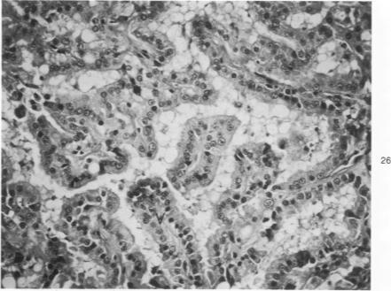 https://cdn.ncbi.nlm.nih.gov/pmc/blobs/d52e/2032435/fa5cc77529ab/amjpathol00449-0115-a.jpg