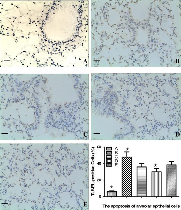 https://cdn.ncbi.nlm.nih.gov/pmc/blobs/d52f/3987841/534f298014a5/1465-9921-15-33-1.jpg