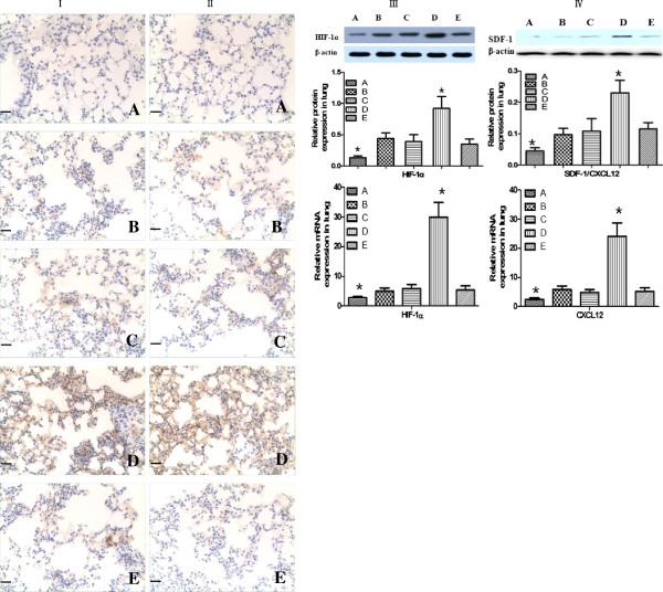 https://cdn.ncbi.nlm.nih.gov/pmc/blobs/d52f/3987841/cb1bebc4cd97/1465-9921-15-33-4.jpg
