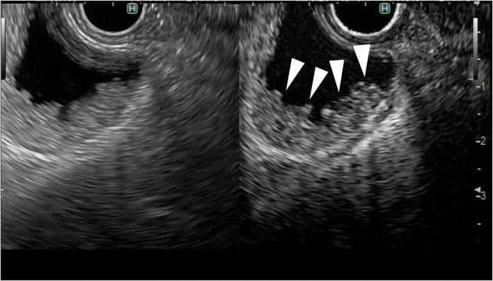https://cdn.ncbi.nlm.nih.gov/pmc/blobs/d532/9465250/18061172767e/fmed-09-957557-g0007.jpg