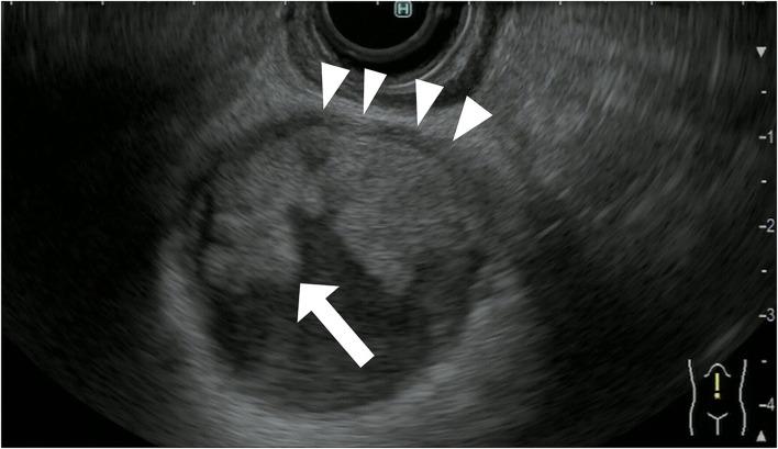 https://cdn.ncbi.nlm.nih.gov/pmc/blobs/d532/9465250/3c5a07df9db8/fmed-09-957557-g0008.jpg