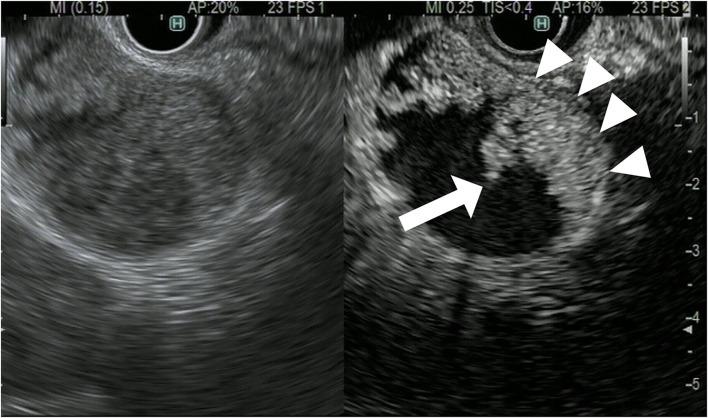 https://cdn.ncbi.nlm.nih.gov/pmc/blobs/d532/9465250/509faee71577/fmed-09-957557-g0010.jpg