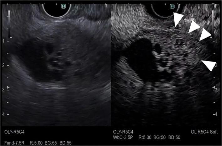 https://cdn.ncbi.nlm.nih.gov/pmc/blobs/d532/9465250/709ca8ca54db/fmed-09-957557-g0011.jpg