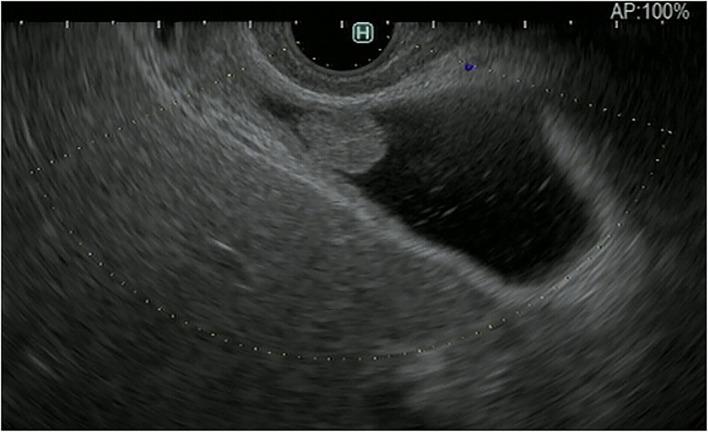 https://cdn.ncbi.nlm.nih.gov/pmc/blobs/d532/9465250/860ec4e522ff/fmed-09-957557-g0001.jpg