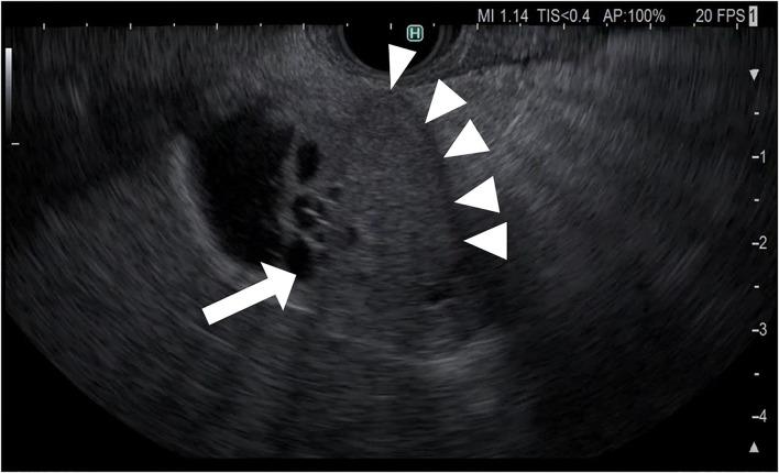https://cdn.ncbi.nlm.nih.gov/pmc/blobs/d532/9465250/92eafd2d0e12/fmed-09-957557-g0009.jpg