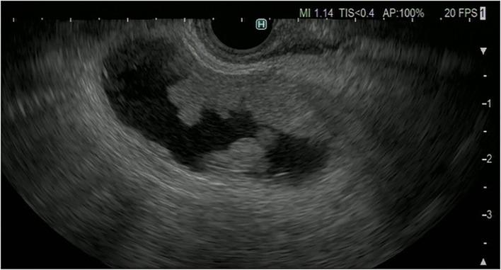 https://cdn.ncbi.nlm.nih.gov/pmc/blobs/d532/9465250/9e9e2cec7fc7/fmed-09-957557-g0006.jpg