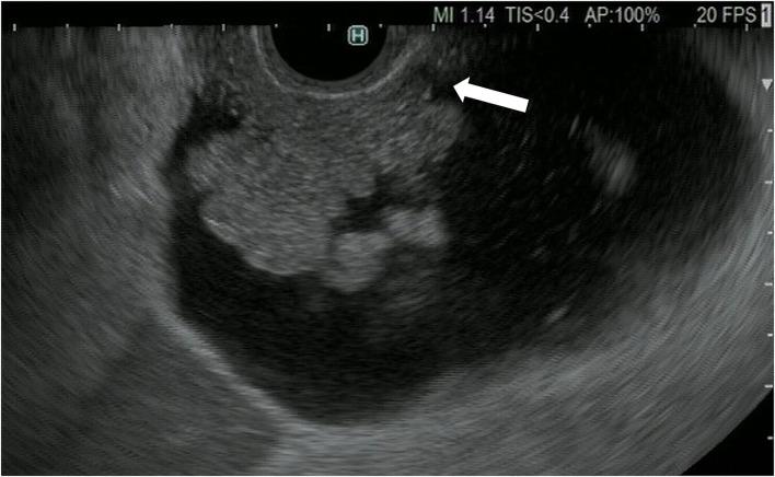 https://cdn.ncbi.nlm.nih.gov/pmc/blobs/d532/9465250/b11651874865/fmed-09-957557-g0002.jpg