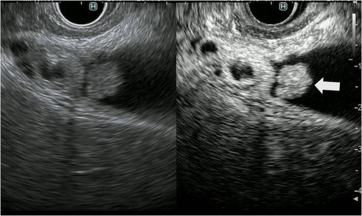 https://cdn.ncbi.nlm.nih.gov/pmc/blobs/d532/9465250/da972515c712/fmed-09-957557-g0003.jpg