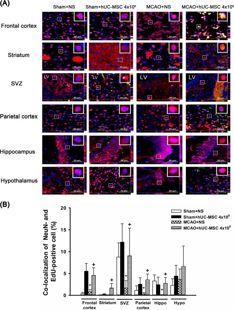 https://cdn.ncbi.nlm.nih.gov/pmc/blobs/d535/5784525/2808339d343d/10.1177_0963689717728936-fig5.jpg