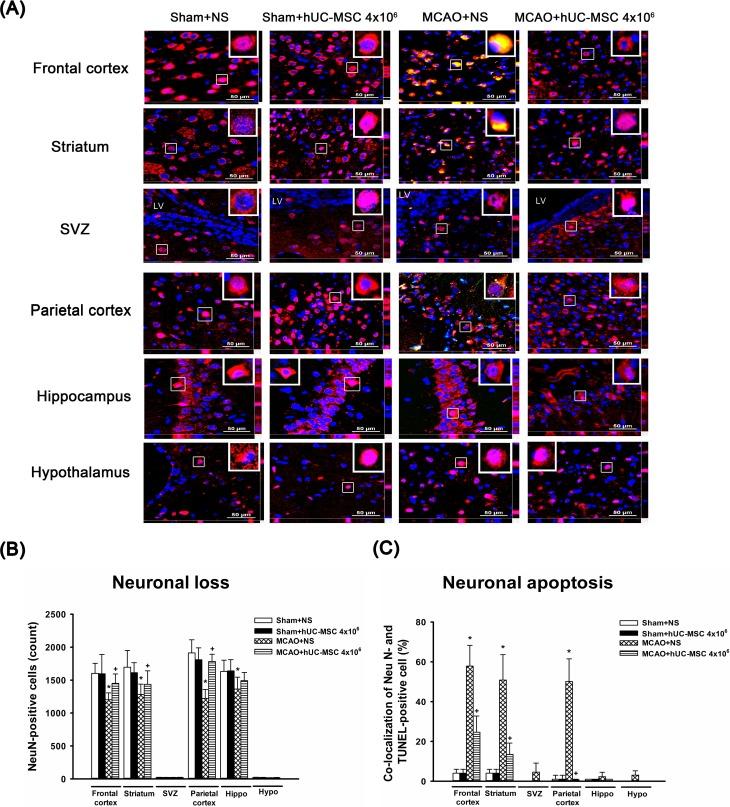 https://cdn.ncbi.nlm.nih.gov/pmc/blobs/d535/5784525/568c11678e8e/10.1177_0963689717728936-fig4.jpg