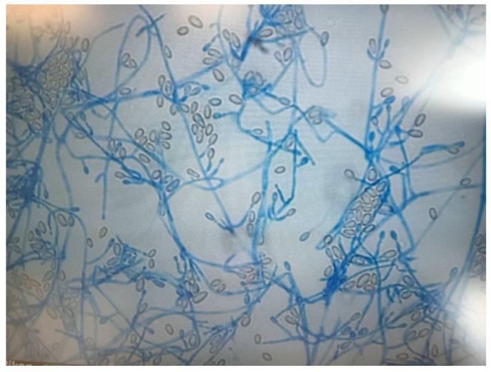 https://cdn.ncbi.nlm.nih.gov/pmc/blobs/d53b/12028247/b151e98d0ed8/jof-11-00270-g002.jpg