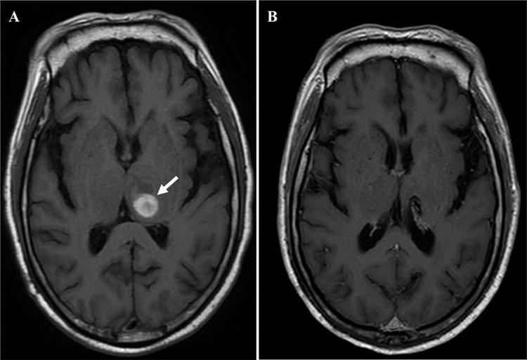 https://cdn.ncbi.nlm.nih.gov/pmc/blobs/d53d/11193441/12f9d0cef167/OTT-17-499-g0002.jpg
