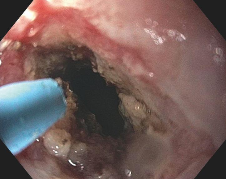 https://cdn.ncbi.nlm.nih.gov/pmc/blobs/d540/10869208/63ba4a7a57cf/10-1055-a-2230-7372_22307535.jpg