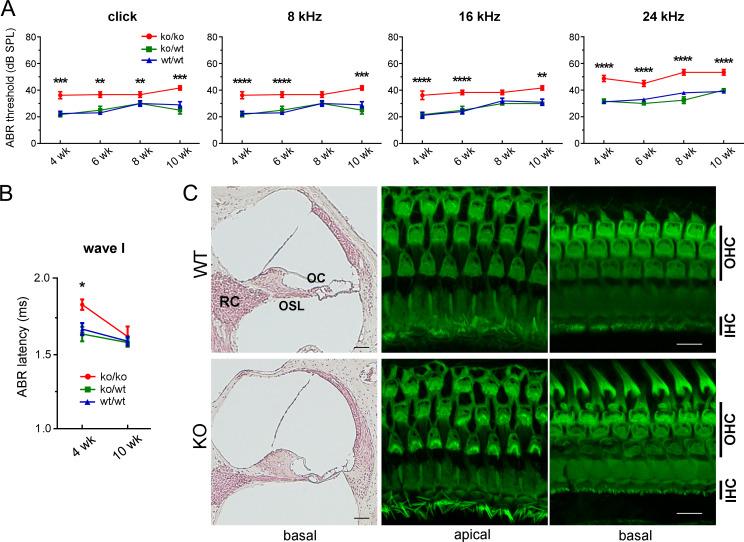 https://cdn.ncbi.nlm.nih.gov/pmc/blobs/d540/7274486/b4337755b919/pgen.1008826.g003.jpg