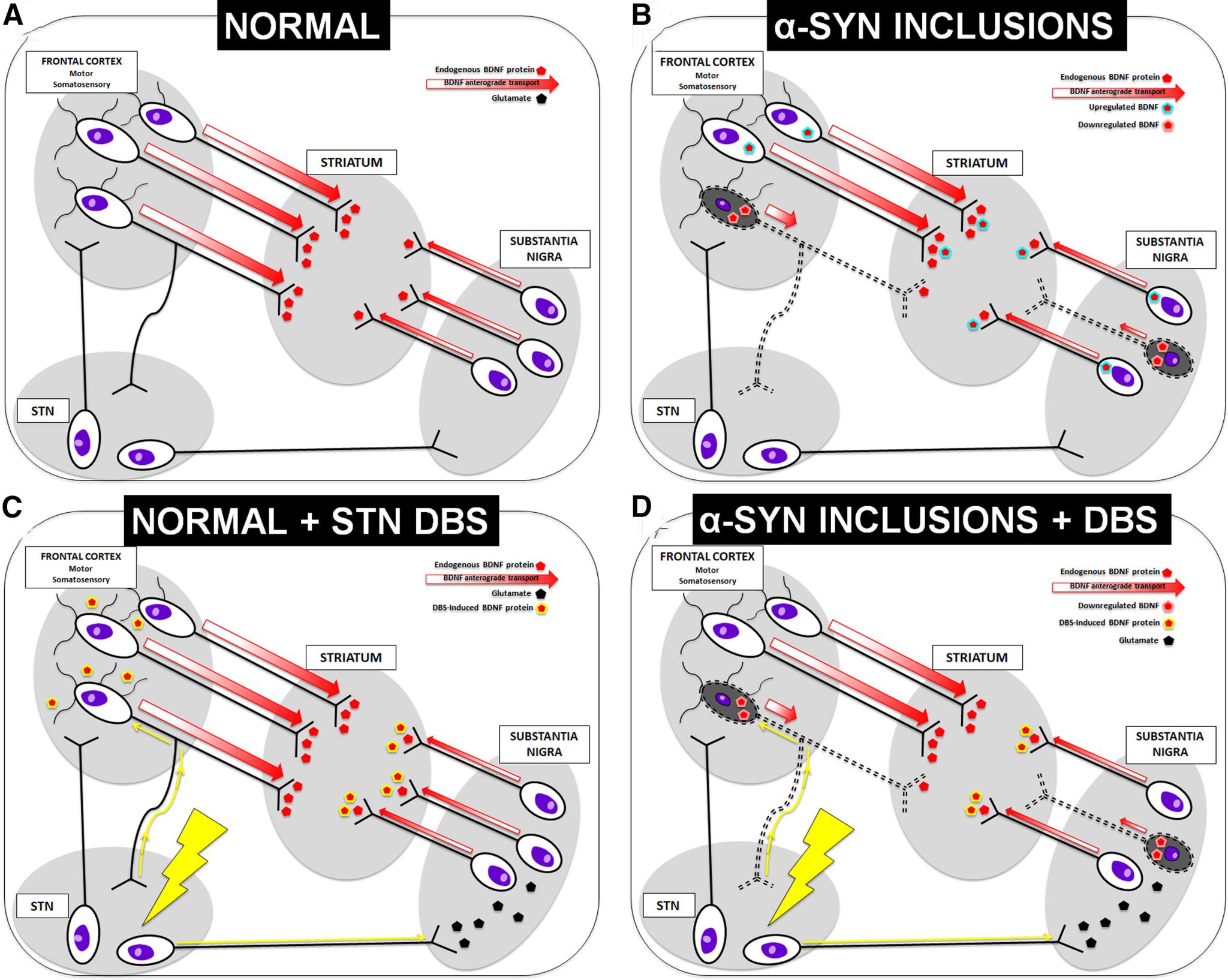 https://cdn.ncbi.nlm.nih.gov/pmc/blobs/d543/7939095/7f8af2090279/SN-JNSJ210036F008.jpg
