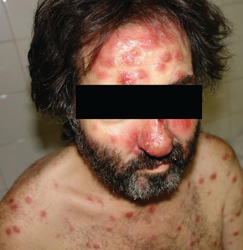 https://cdn.ncbi.nlm.nih.gov/pmc/blobs/d546/3892643/67af172aebb5/idr-2012-1-e15-g001.jpg