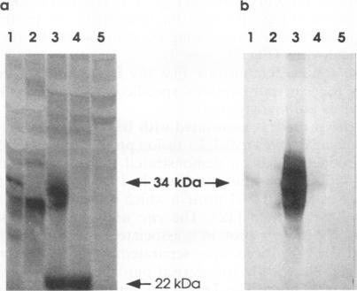 https://cdn.ncbi.nlm.nih.gov/pmc/blobs/d548/237272/7db9f13bb9d4/jvirol00021-0431-c.jpg