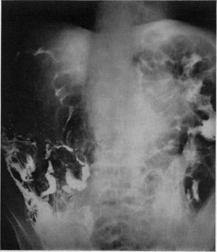 https://cdn.ncbi.nlm.nih.gov/pmc/blobs/d551/2467062/588cd26b3401/postmedj00355-0038-b.jpg