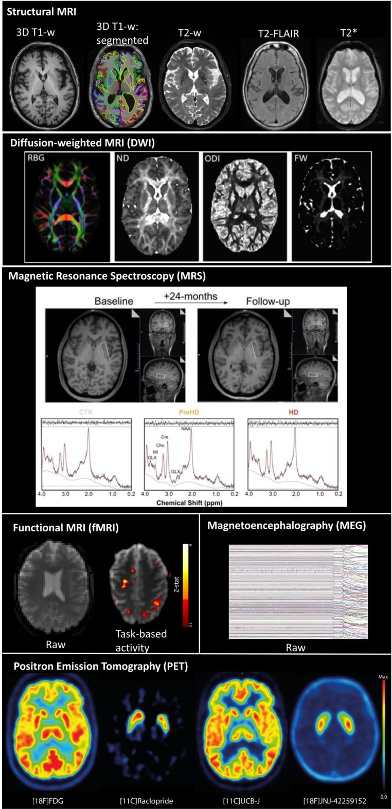 https://cdn.ncbi.nlm.nih.gov/pmc/blobs/d560/11307036/0a615cf31f5a/jhd-13-jhd240016-g001.jpg
