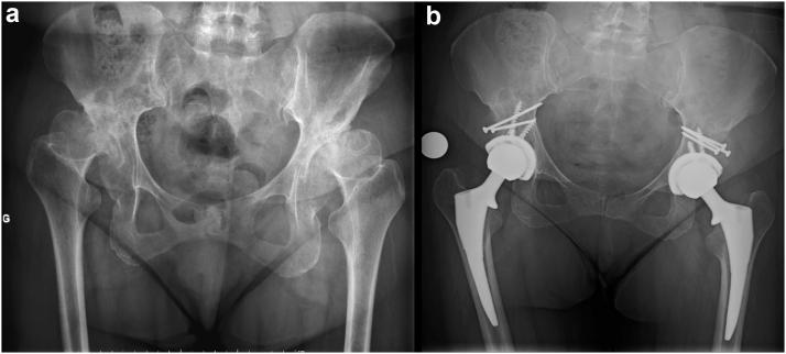 https://cdn.ncbi.nlm.nih.gov/pmc/blobs/d563/8933727/b35bf8006e52/gr3.jpg