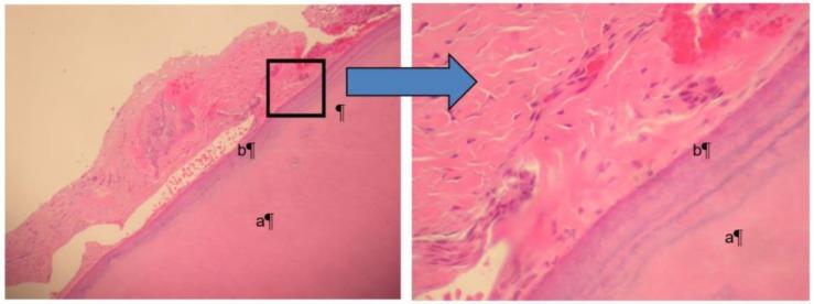 https://cdn.ncbi.nlm.nih.gov/pmc/blobs/d567/6313740/4356266bc896/dentistry-06-00053-g005.jpg