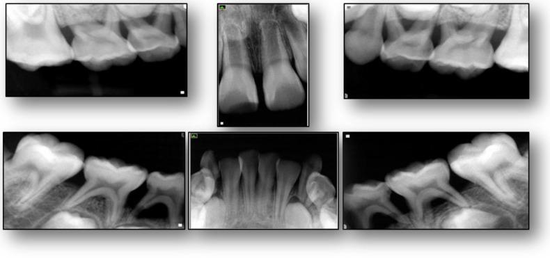 https://cdn.ncbi.nlm.nih.gov/pmc/blobs/d567/6313740/8adfeeea20a2/dentistry-06-00053-g002.jpg