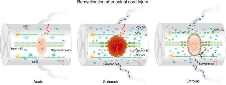 https://cdn.ncbi.nlm.nih.gov/pmc/blobs/d56a/8993811/e5b8a1bb601e/41413_2022_199_Fig4_HTML.jpg