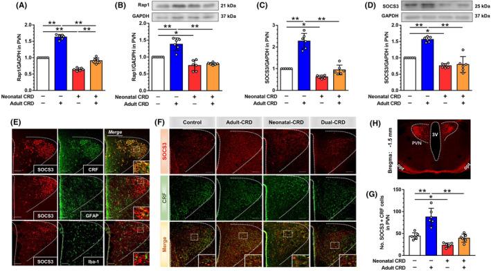 https://cdn.ncbi.nlm.nih.gov/pmc/blobs/d56d/9344090/340311a6a3b3/CNS-28-1393-g001.jpg