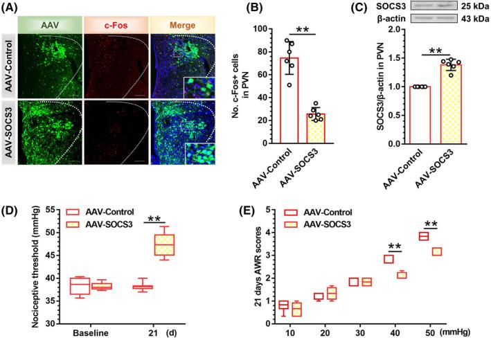 https://cdn.ncbi.nlm.nih.gov/pmc/blobs/d56d/9344090/e6b07dd46362/CNS-28-1393-g004.jpg