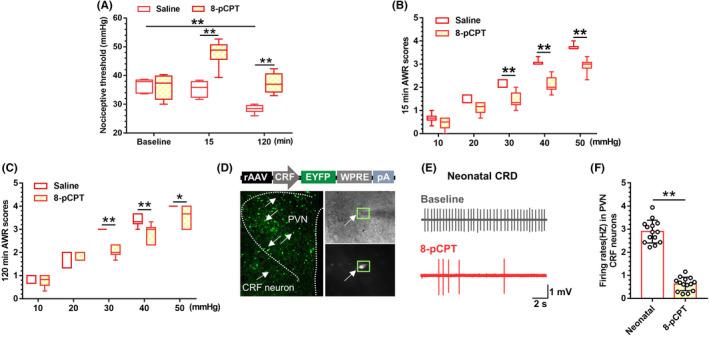 https://cdn.ncbi.nlm.nih.gov/pmc/blobs/d56d/9344090/fd4f5219464a/CNS-28-1393-g007.jpg