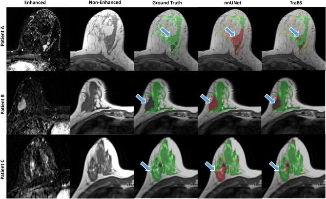 https://cdn.ncbi.nlm.nih.gov/pmc/blobs/d570/10468506/3bd6cf75efbe/41598_2023_41331_Fig3_HTML.jpg