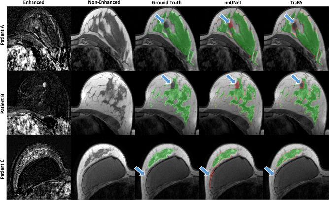 https://cdn.ncbi.nlm.nih.gov/pmc/blobs/d570/10468506/a0279dbfdf69/41598_2023_41331_Fig2_HTML.jpg