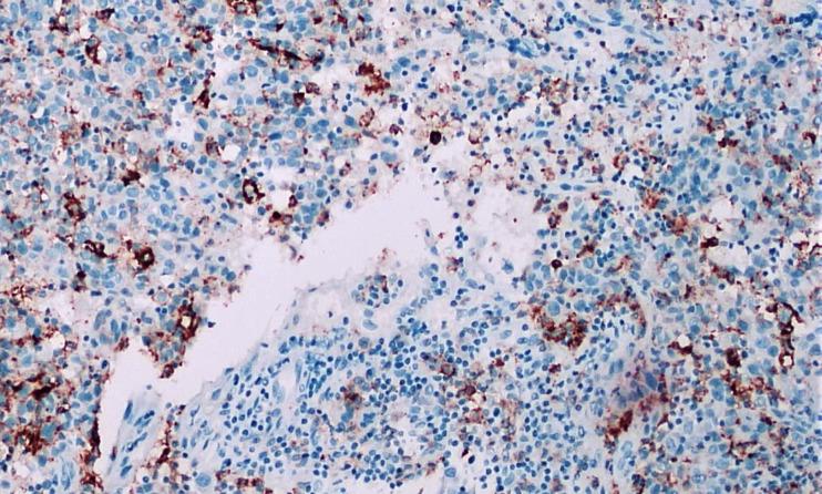 https://cdn.ncbi.nlm.nih.gov/pmc/blobs/d572/9080348/7bdbf18136a9/APJCP-22-3921-g003.jpg