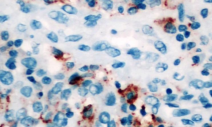 https://cdn.ncbi.nlm.nih.gov/pmc/blobs/d572/9080348/f35da79f1df7/APJCP-22-3921-g004.jpg