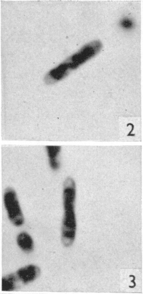 https://cdn.ncbi.nlm.nih.gov/pmc/blobs/d575/2234922/1e142c6745f8/jhyg00175-0088-b.jpg