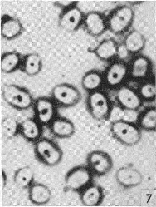 https://cdn.ncbi.nlm.nih.gov/pmc/blobs/d575/2234922/851e232381af/jhyg00175-0088-f.jpg