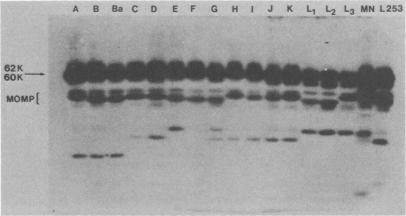 https://cdn.ncbi.nlm.nih.gov/pmc/blobs/d57f/347873/881d0678284b/iai00147-0389-a.jpg