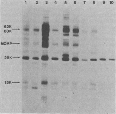 https://cdn.ncbi.nlm.nih.gov/pmc/blobs/d57f/347873/fc752564b88d/iai00147-0389-b.jpg