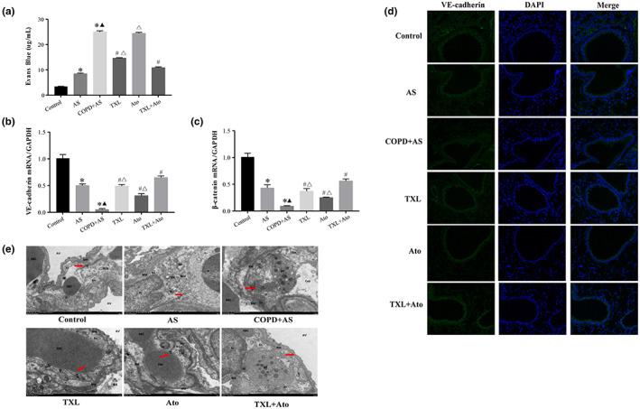 https://cdn.ncbi.nlm.nih.gov/pmc/blobs/d57f/9834855/1b1c5e083c6d/FSN3-11-390-g002.jpg