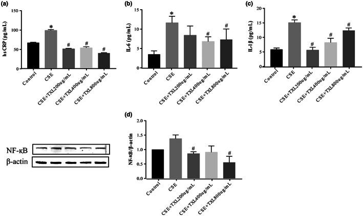 https://cdn.ncbi.nlm.nih.gov/pmc/blobs/d57f/9834855/23d6dba72ce3/FSN3-11-390-g008.jpg