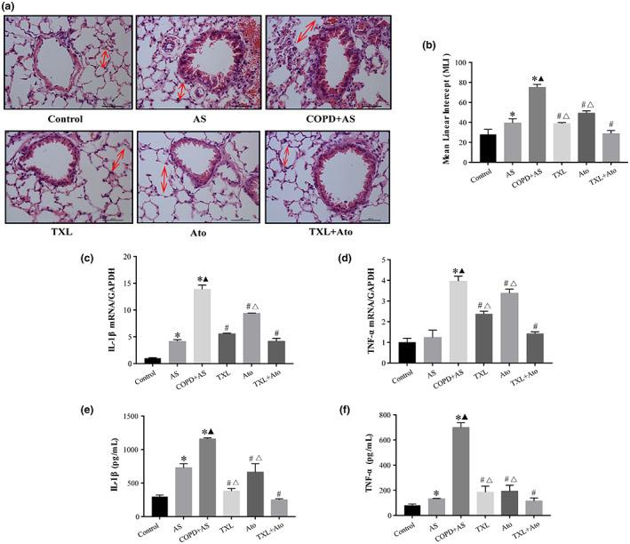 https://cdn.ncbi.nlm.nih.gov/pmc/blobs/d57f/9834855/25ebe84b205d/FSN3-11-390-g001.jpg