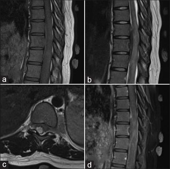 https://cdn.ncbi.nlm.nih.gov/pmc/blobs/d582/6208211/ea3d976cd810/AJNS-13-1216-g001.jpg