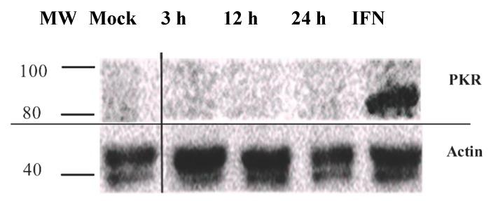https://cdn.ncbi.nlm.nih.gov/pmc/blobs/d58f/4926193/03e78213f1a6/viruses-08-00173-g003.jpg
