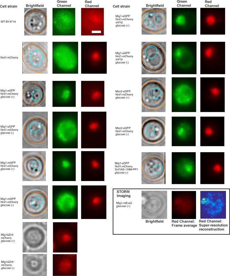https://cdn.ncbi.nlm.nih.gov/pmc/blobs/d58f/5602325/64e5e4c8f681/elife-27451-fig1-figsupp1.jpg