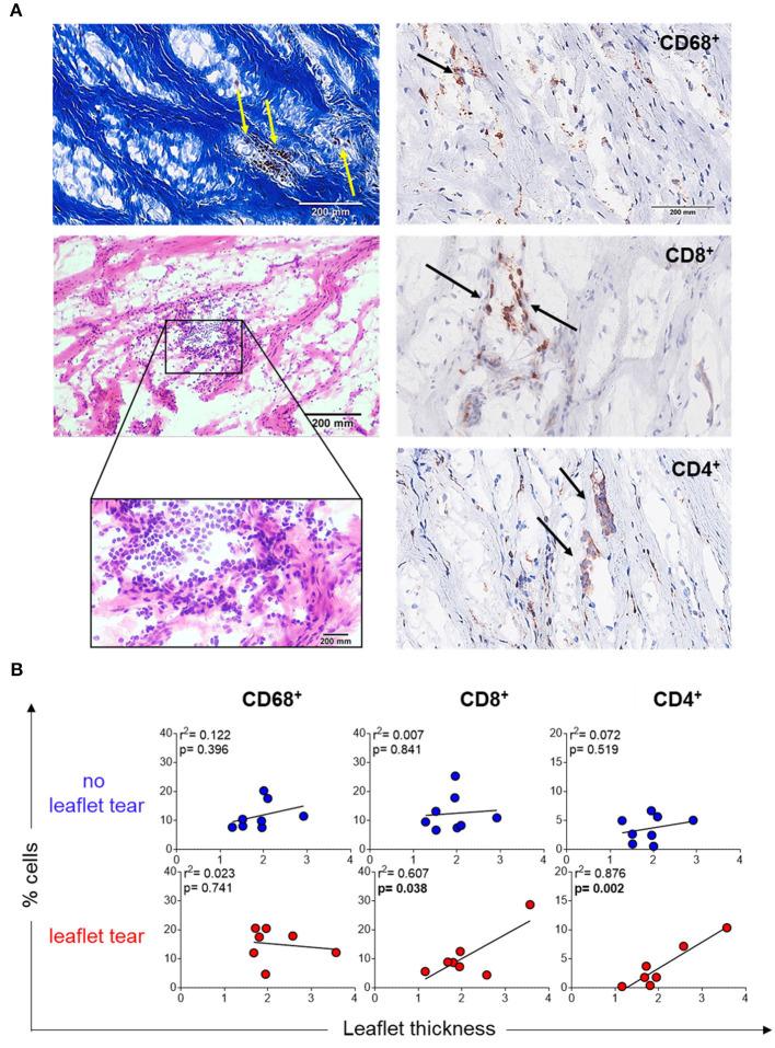 https://cdn.ncbi.nlm.nih.gov/pmc/blobs/d593/8811173/3ed88c412bee/fcvm-08-804111-g0002.jpg